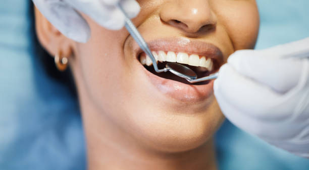 Best Emergency Dental Care for Broken or Chipped Teeth in Towson, MD