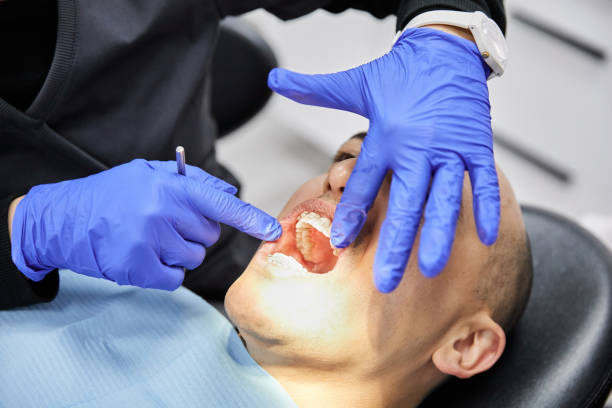 Best Emergency Treatment for Dental Infections or Abscesses in Towson, MD