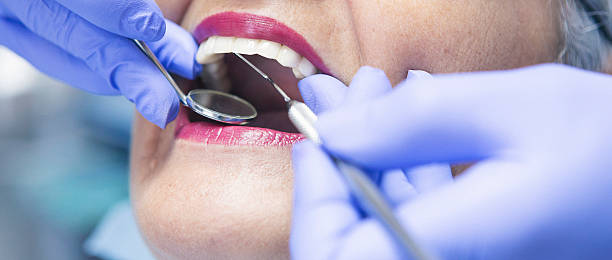 Best Emergency Root Canal Treatment in Towson, MD